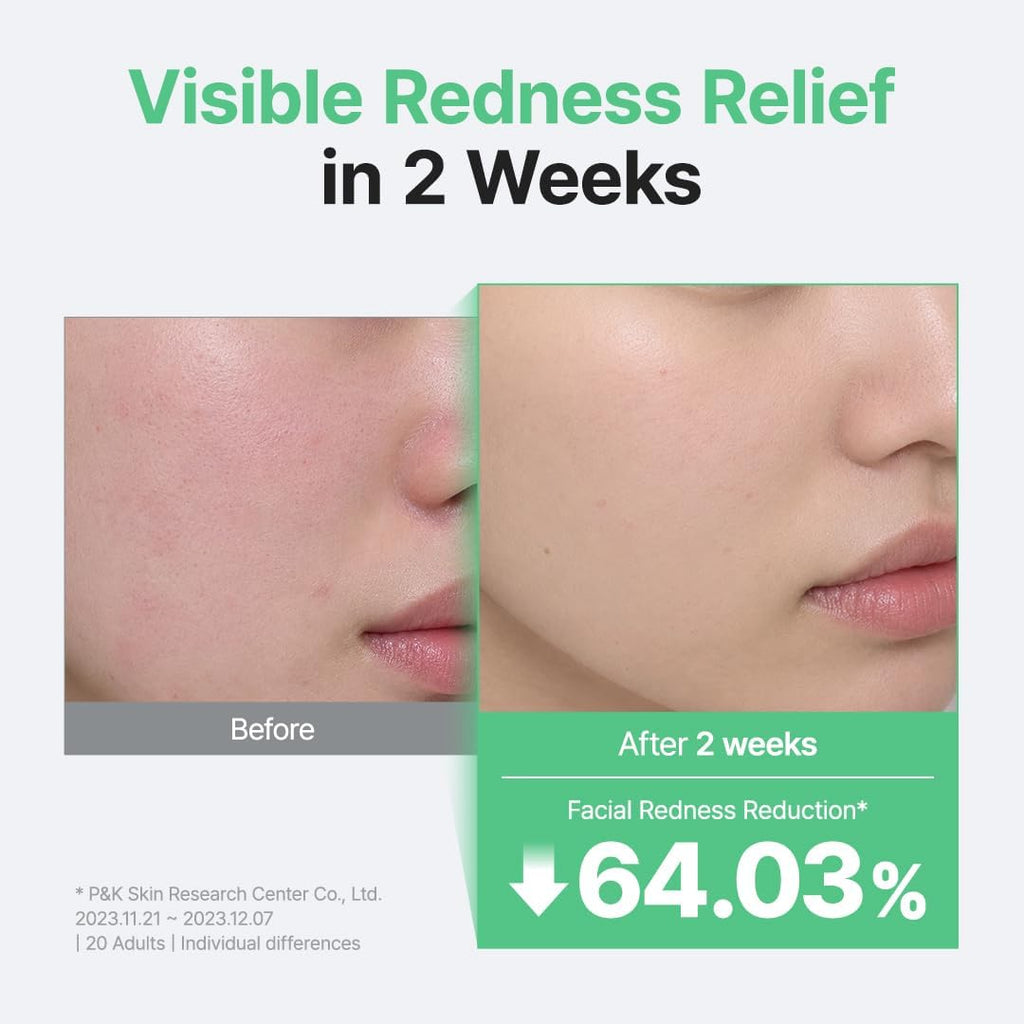 Centella Unscented Serum for Sensitive Skin, 60Ml