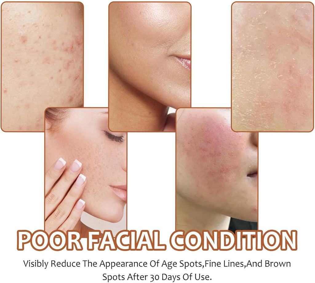 Kojic Acid Toner Suitable for All Skin Type,Gylcolic Acid,Glycolic Acid 7%,Toner Skincare,Hydrating Toner,Brighten,Rejuvenate Moisturize & Strengthen Your Skin