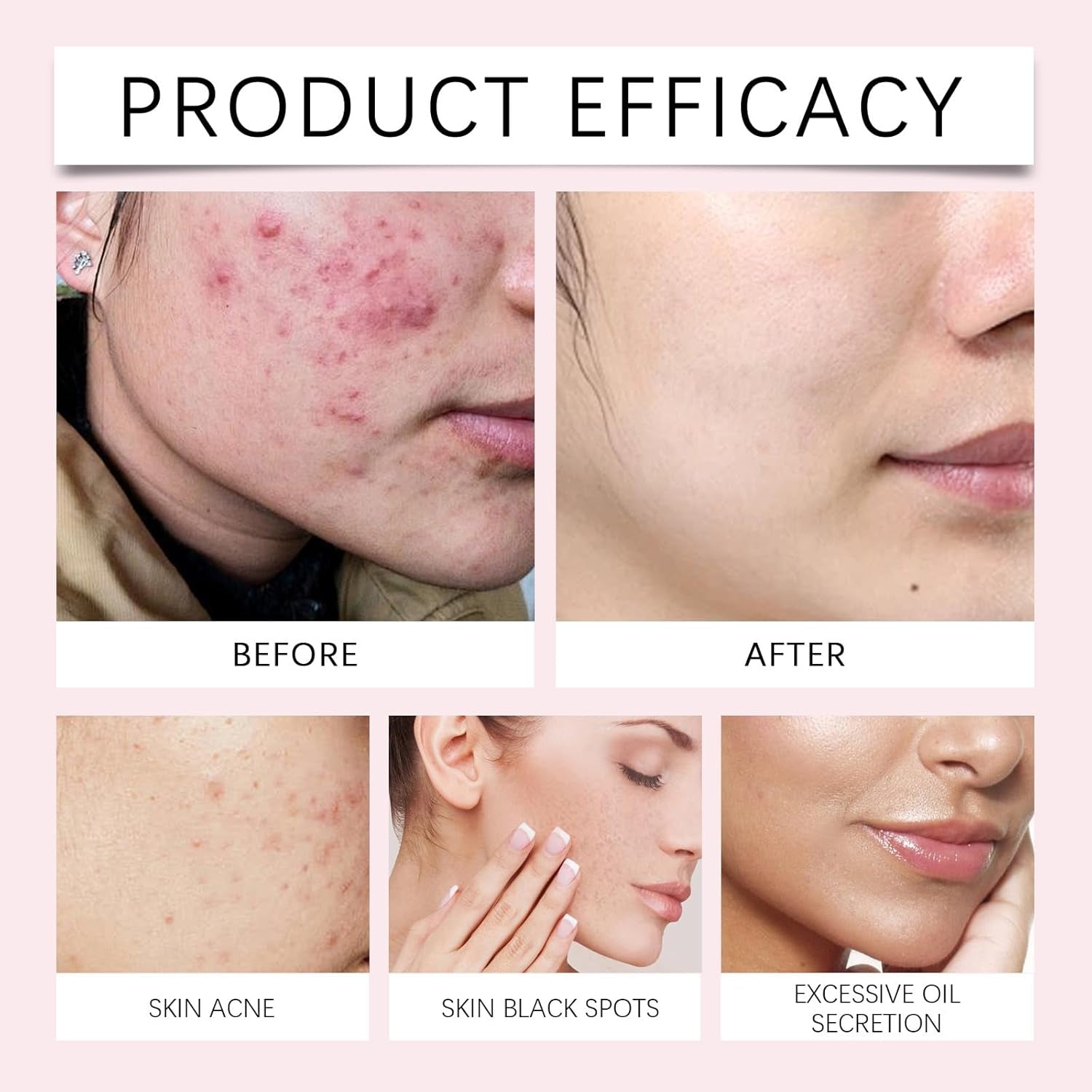 Kojic Acid Toner Suitable for All Skin Type,Gylcolic Acid,Glycolic Acid 7%,Toner Skincare,Hydrating Toner,Brighten,Rejuvenate Moisturize & Strengthen Your Skin