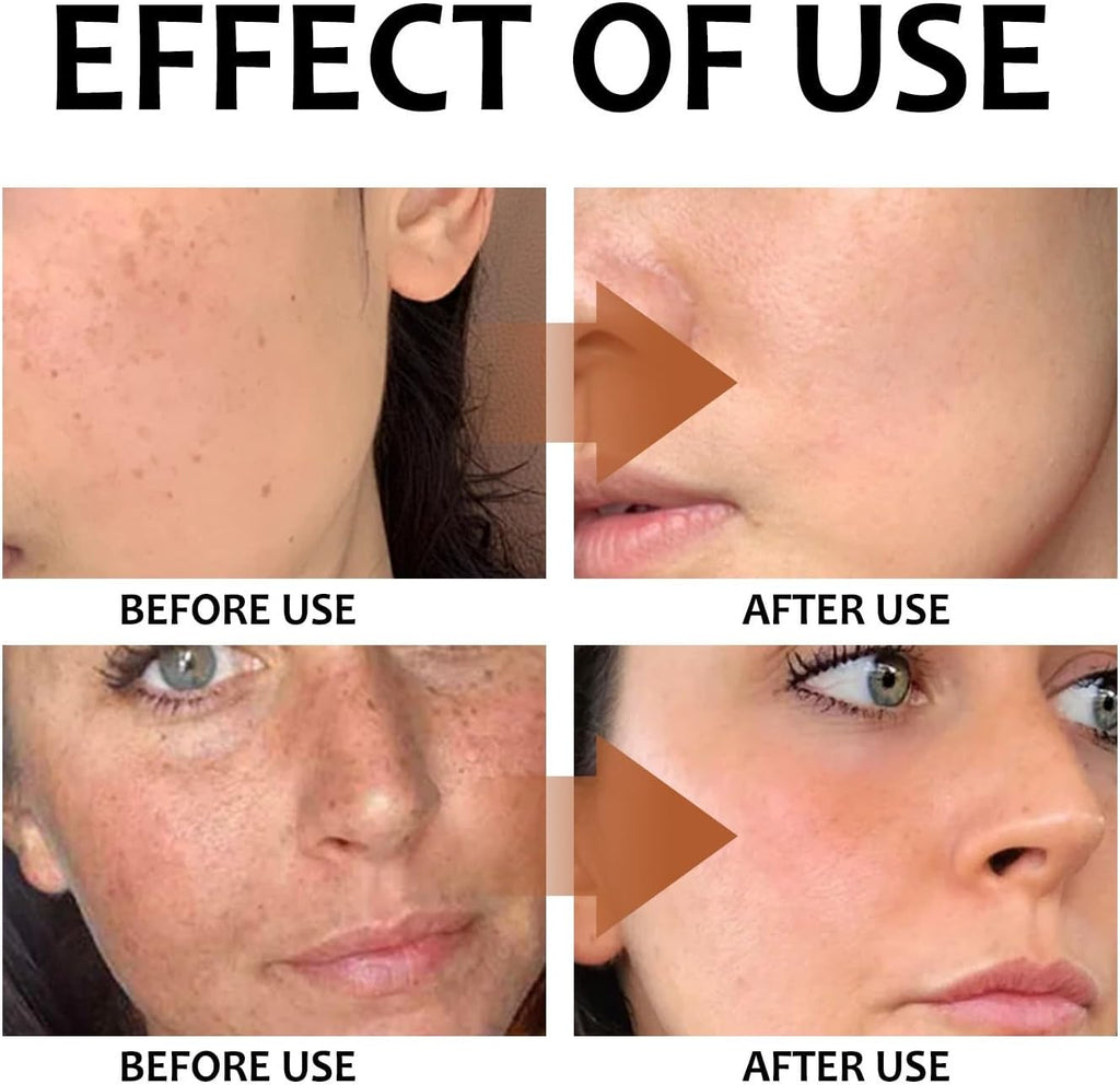 Kojic Acid Toner Suitable for All Skin Type,Gylcolic Acid,Glycolic Acid 7%,Toner Skincare,Hydrating Toner,Brighten,Rejuvenate Moisturize & Strengthen Your Skin